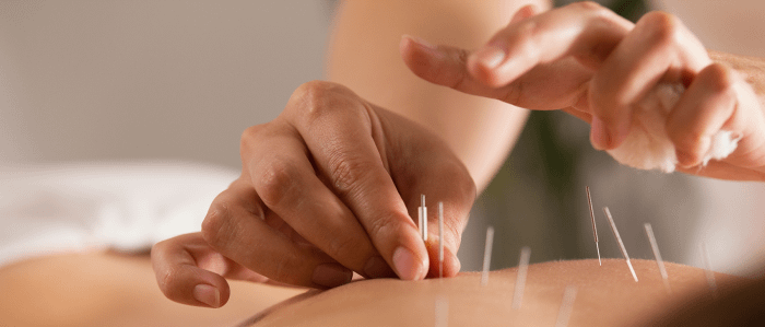 Haddonfield Acupuncture
